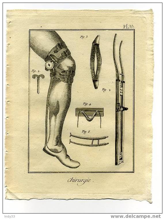 - "CHIRURGIE PL. 33". EAU FORTE DU XVIIIe S. - Medisch En Tandheelkundig Materiaal