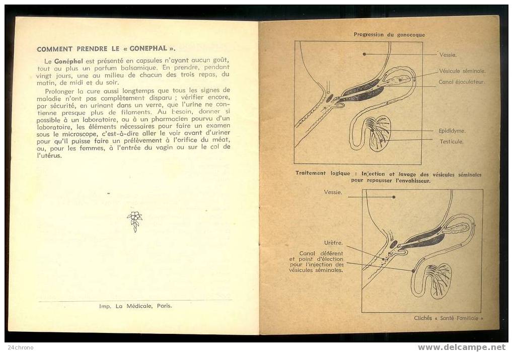 Fascicule Sur La Medecine: Les Infections Des Voies Urinaires Et Leur Traitement, La Blennorragie Et Le Gonephal (07-964 - Medicina & Salute