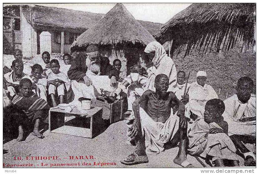 ETHIOPIE .HARAR. LEPROSERIE . LE PANSEMENT DES LEPREUX . - Äthiopien