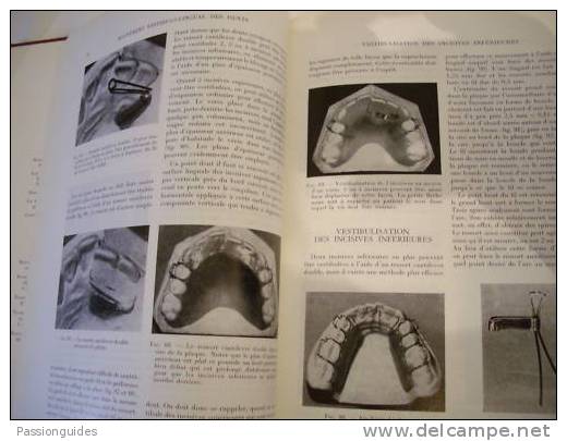 APPAREILS ORTHODONTIQUES AMOVIBLES (étude Et Construction) C. PHILIP ADAMS 1973 / 2ème édition / 282 FIGURES Dentisterie - Wetenschap