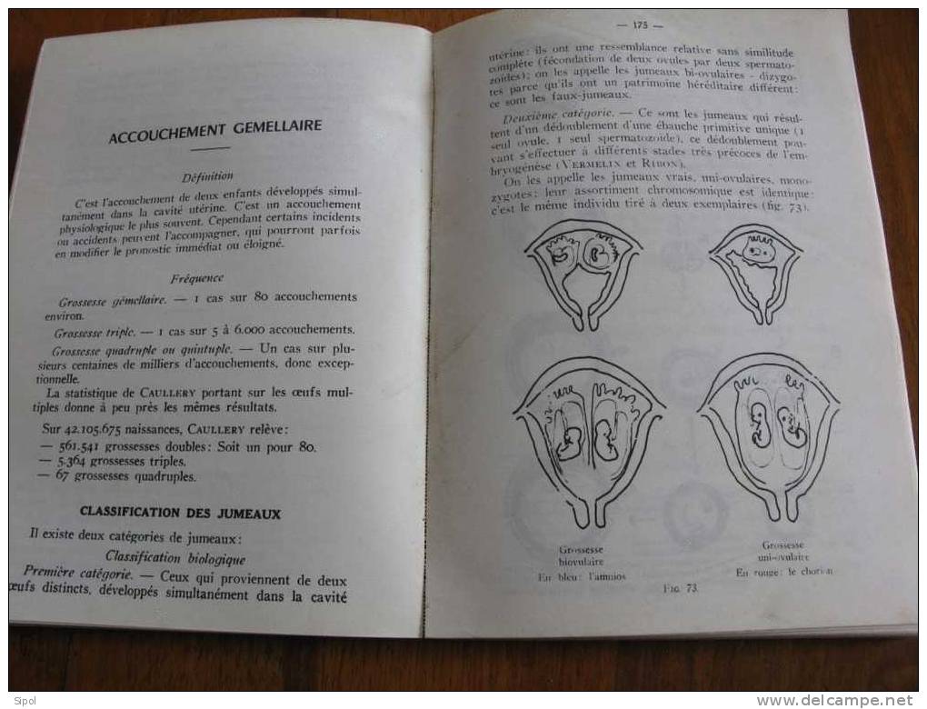 Cliniques Obstétricales Par Jean Richon - N Est Plus éditié  Imprimerie Georges Thomas Nancy II-1968 - 18+ Jaar
