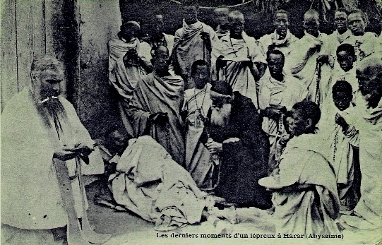 ETHIOPIE - LES DERNIERS MOMENTS D´UN LEPREUX A HARAR (ABYSSINIE) - Ethiopia