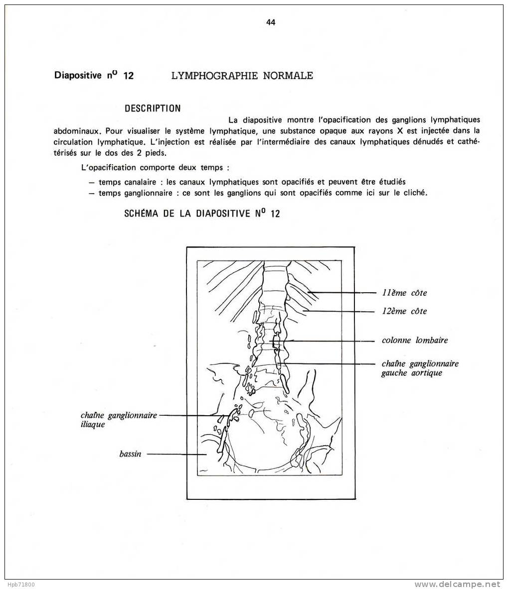 Sciences - Éducation Sur Les Cancers - Dossier Documentaire + 24 Diapositives - Lesekarten