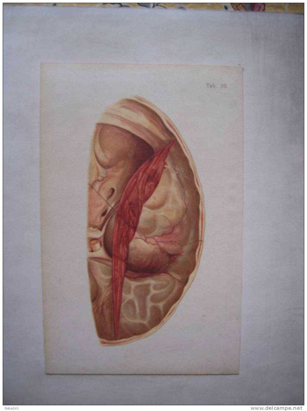 PLANCHES D'ANATOMIE MEDECINE LEGALE - Andere Plannen