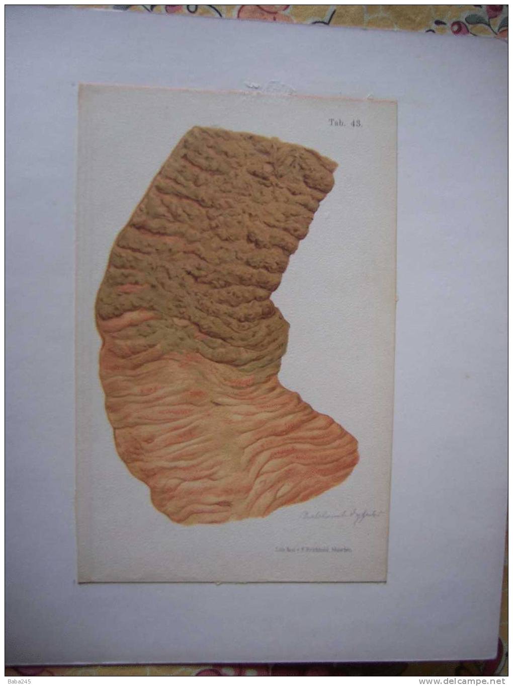 PLANCHES D'ANATOMIE MEDECINE LEGALE - Andere Plannen