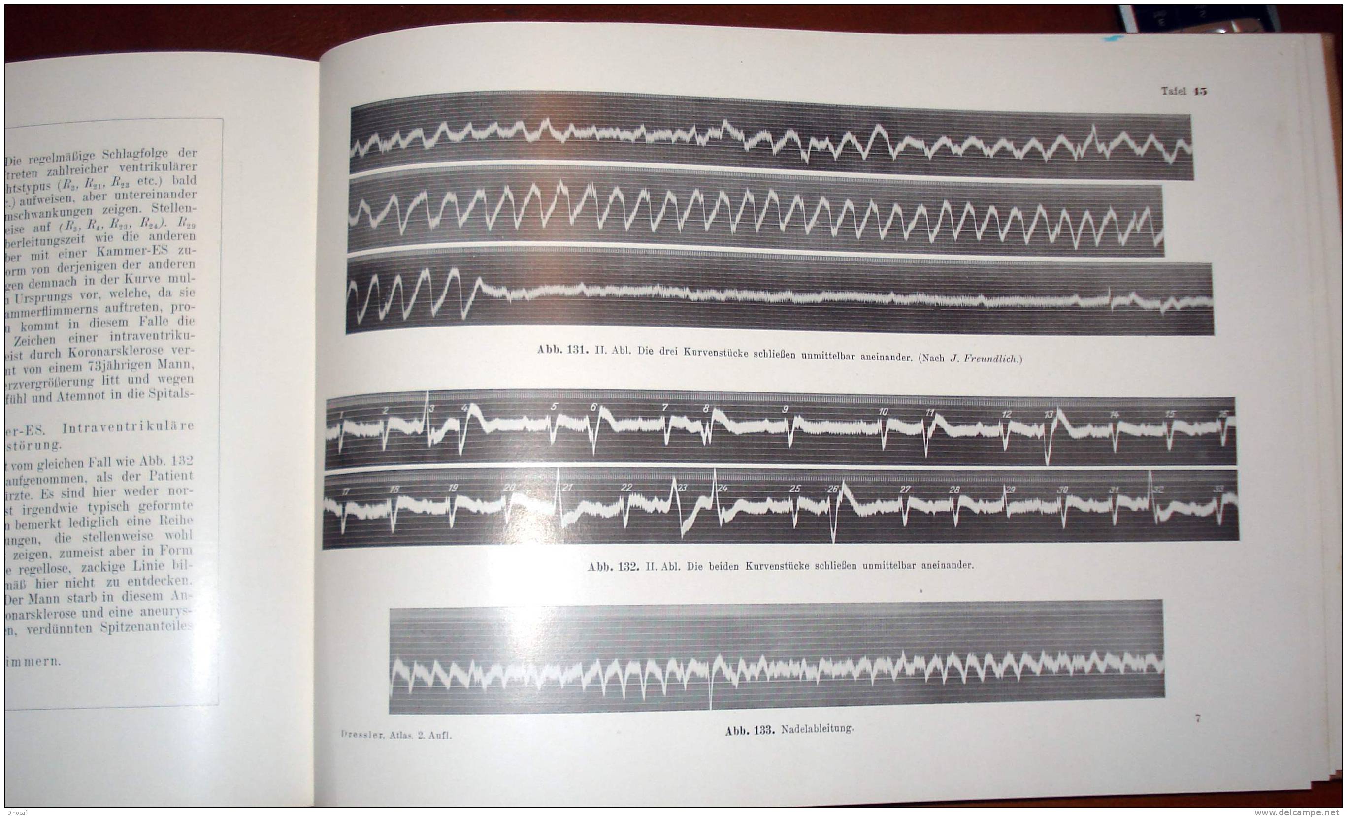 ATLAS DER KLINISCHEN ELEKTROKARDIOGRAPHIE, MIT 164 ABBILDUNGEN AUF 58 TAFELN, 150 SEITEN, **1936** - Altri & Non Classificati