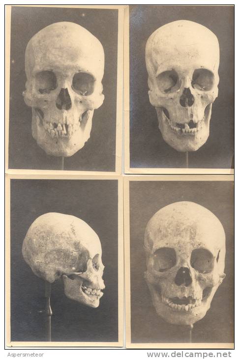 RARA COLECCION DE 7 FOTOGRAFIAS DE CRANEOS SKULLS QUE PERTENECIERA A UN ANTROPOLOGO ARGENTINO CIRCA 1910 RARES - Health