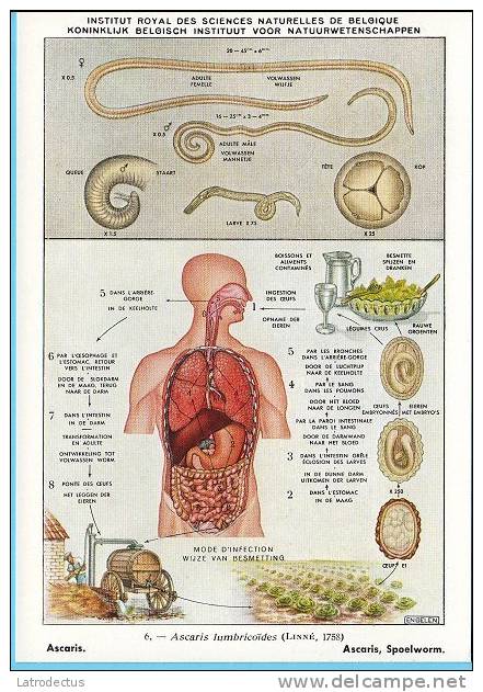 KBIN (ca 1950) - Parasitic Worms (humans) - 6 - Ascaris Lumbricoides, Giant Roundworm, Spoelworm - Autres & Non Classés