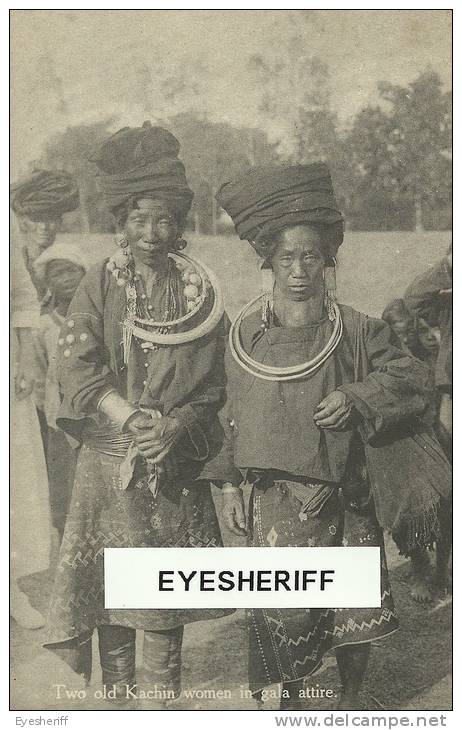 Myanmar (Birma/Burma): Kachin Woman On The Right With Goiter (goitre - Struma). Rare! - Myanmar (Burma)