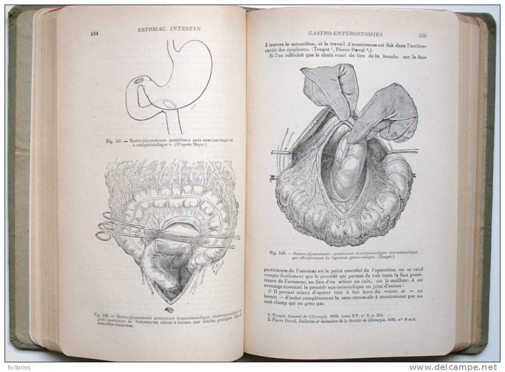 CHIRURGIE De L´ABDOMEN (Précis De Technique Opératoire) - 1930  Médecine  /B42 - Health