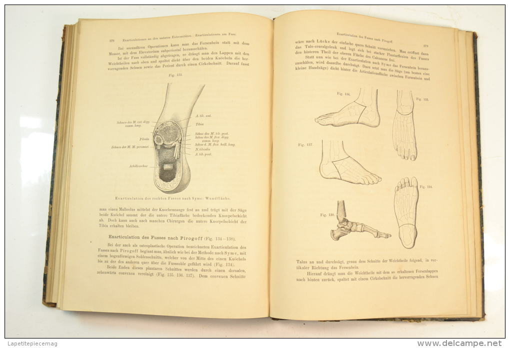 1884 lehrbuch der topographisch-chirurgischen. Livre de chirurgie, terminaisons nerveuses, amputation. Medecin WW1