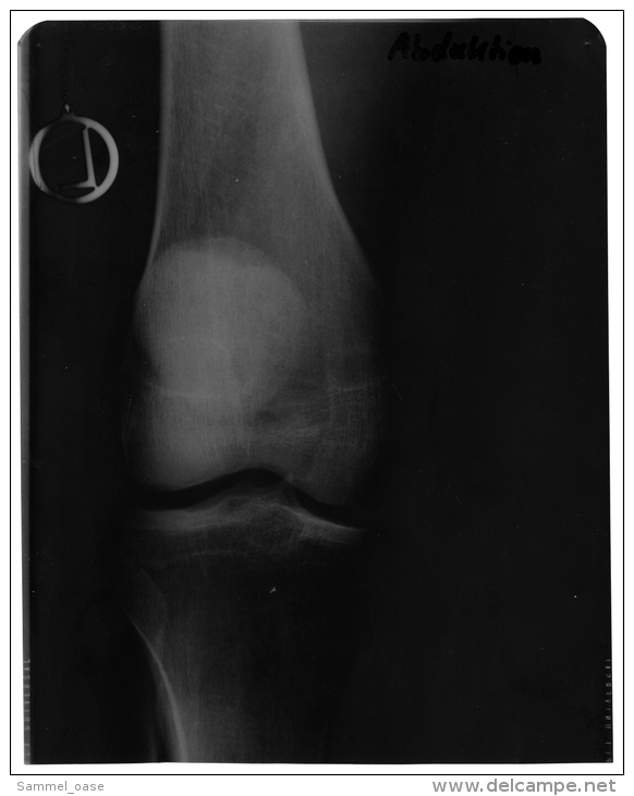 2 Original Kunststoff Röntgenbilder Von Einem Knie Eines Manns  -  Von 1982   (63) - Sonstige & Ohne Zuordnung