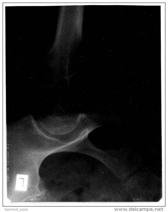 2 Original Kunststoff Röntgenbilder Von Einem Becken Einer 72-jährigen Frau -  Von 1984   (120) - Sonstige & Ohne Zuordnung
