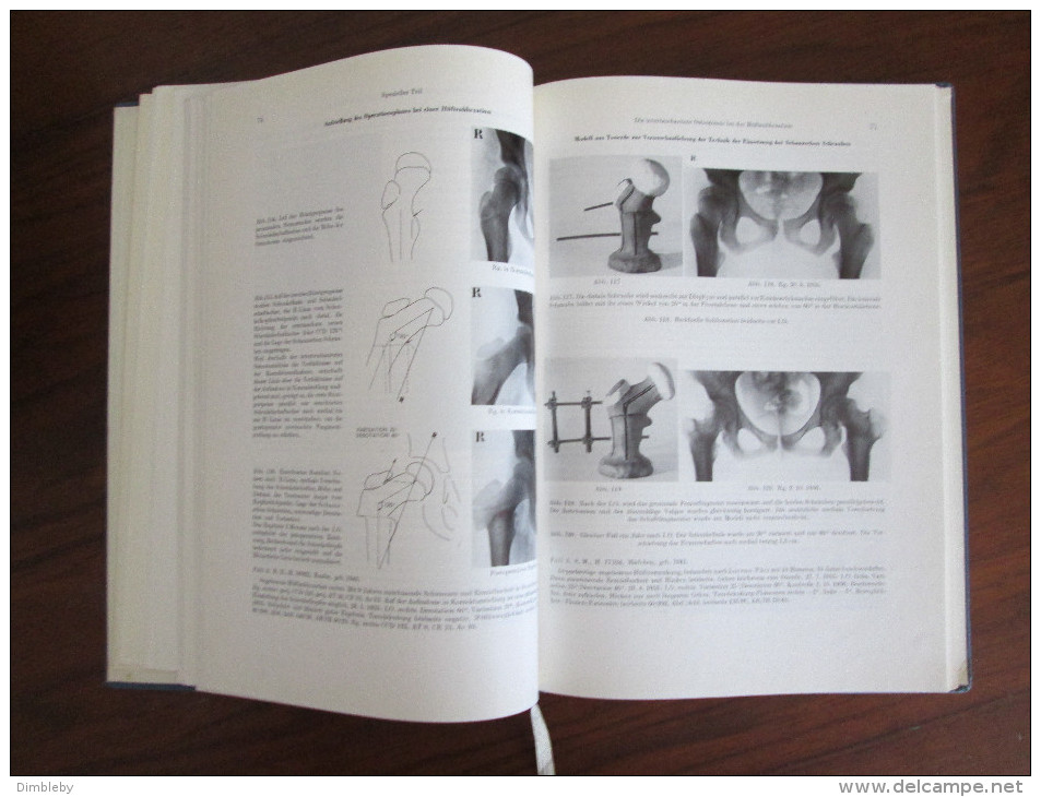 Die hüftnahen Femurosteotomien 1957 -Maurice Edmont Müller Erstauflage / Rarität