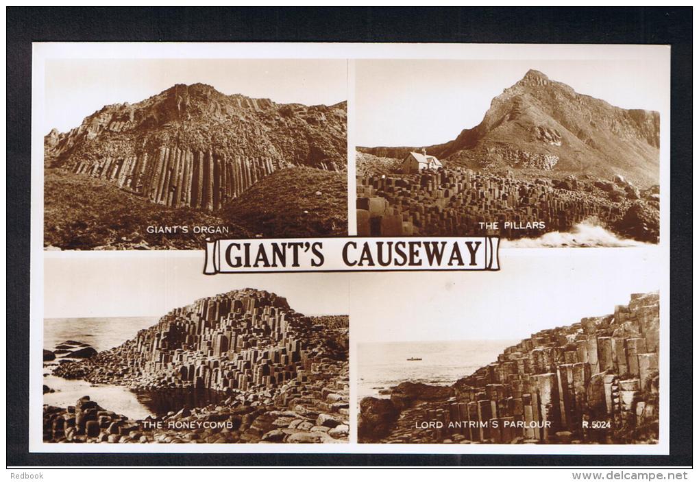 RB 993 - Real Photo Multiview Postcard - Giant's Causeway - Antrim Ireland - Antrim