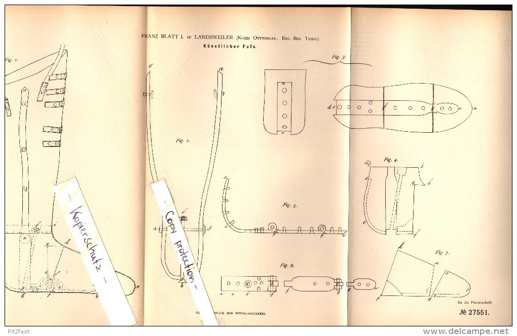 Original Patent - Franz Blatt In Landsweiler B. Lebach , 1883 , Künstlicher Fuß , Prothese !!! - Kreis Saarlouis