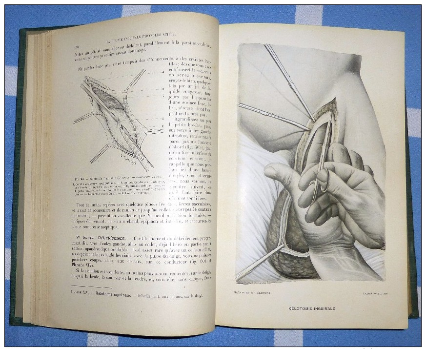 CHIRURGIE D´URGENCE. par F. Lejars - (en 2 volumes 1921)