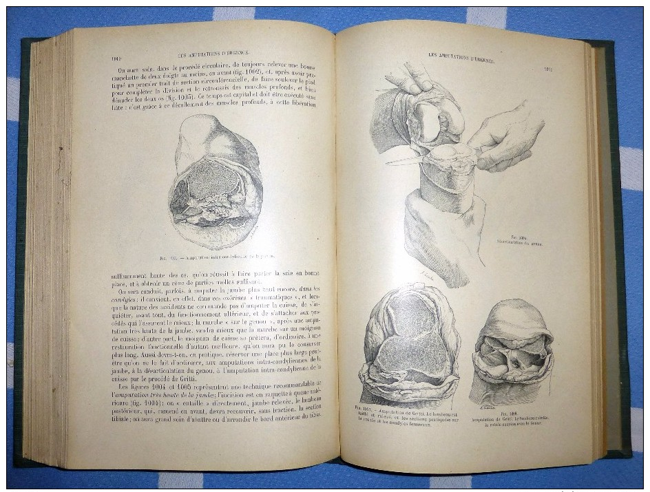 CHIRURGIE D´URGENCE. par F. Lejars - (en 2 volumes 1921)