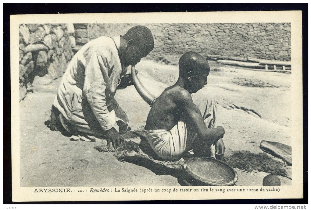 Cpa D´ Ethiopie Abyssinie - Remèdes -- Après Un Coup De Rasoir , On Tire Le Sang Avec Une Corne De Vache    AA8b - Ethiopia