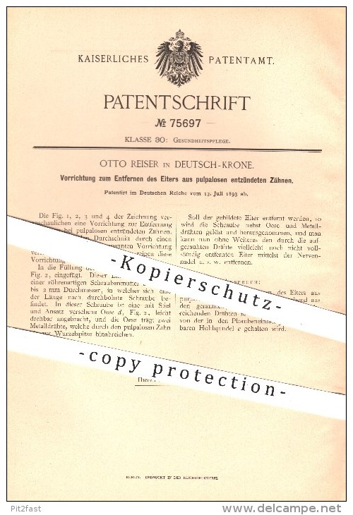 Original Patent - Otto Reiser In Deutsch - Krone , 1893 , Entfernen Von Eiter Aus Zähnen , Zahn , Zähne , Zahnarzt !!! - Historische Dokumente