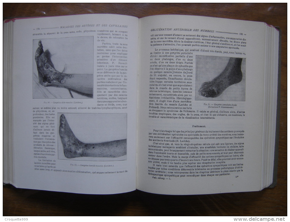 6 TOMES Du Nouveau Precis De Pathologie Chirurgicale Medecine PATEL - Sciences