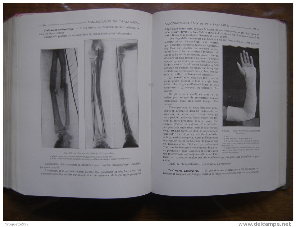 6 TOMES Du Nouveau Precis De Pathologie Chirurgicale Medecine PATEL - Sciences