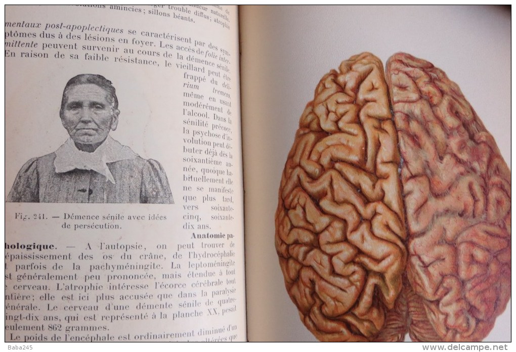 ATLAS MANUEL DE PSYCHIATRIE PAR G WEYGANDT 1904 - 1801-1900