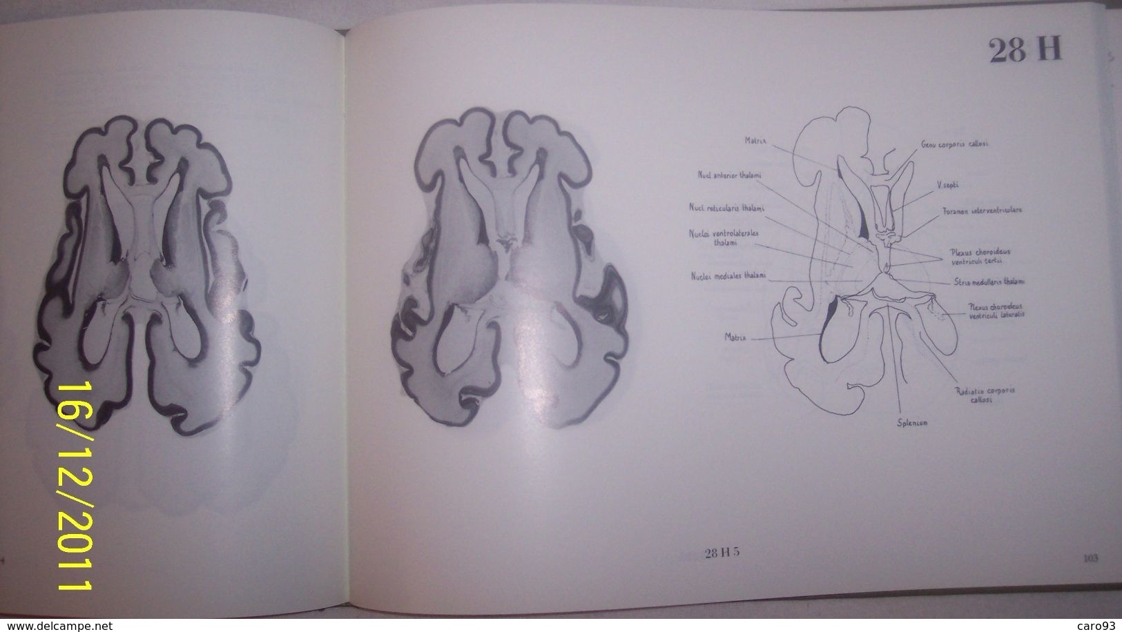 Le Développement Du Cerveau F&oelig;tal Humain » Atlas Anatomique  Inserm CNRS 1987 - Autres & Non Classés