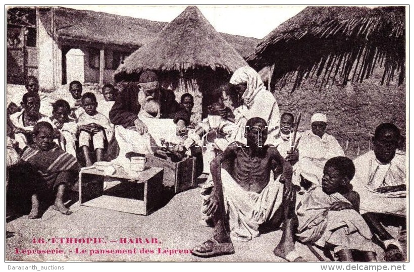 ** T2/T3 Harar, Léprosie. Le Pansement Des Lépreux / Leprosy (EK) - Sin Clasificación