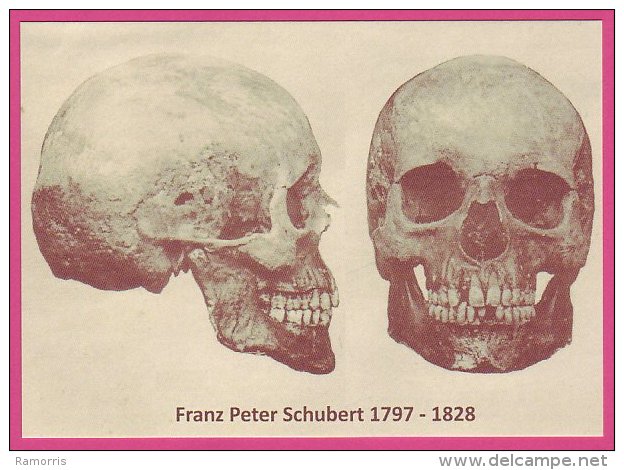 PC00008 Composer Franz Schubert's Skull From The 1888 Exhumation And Reburial - Muziek En Musicus