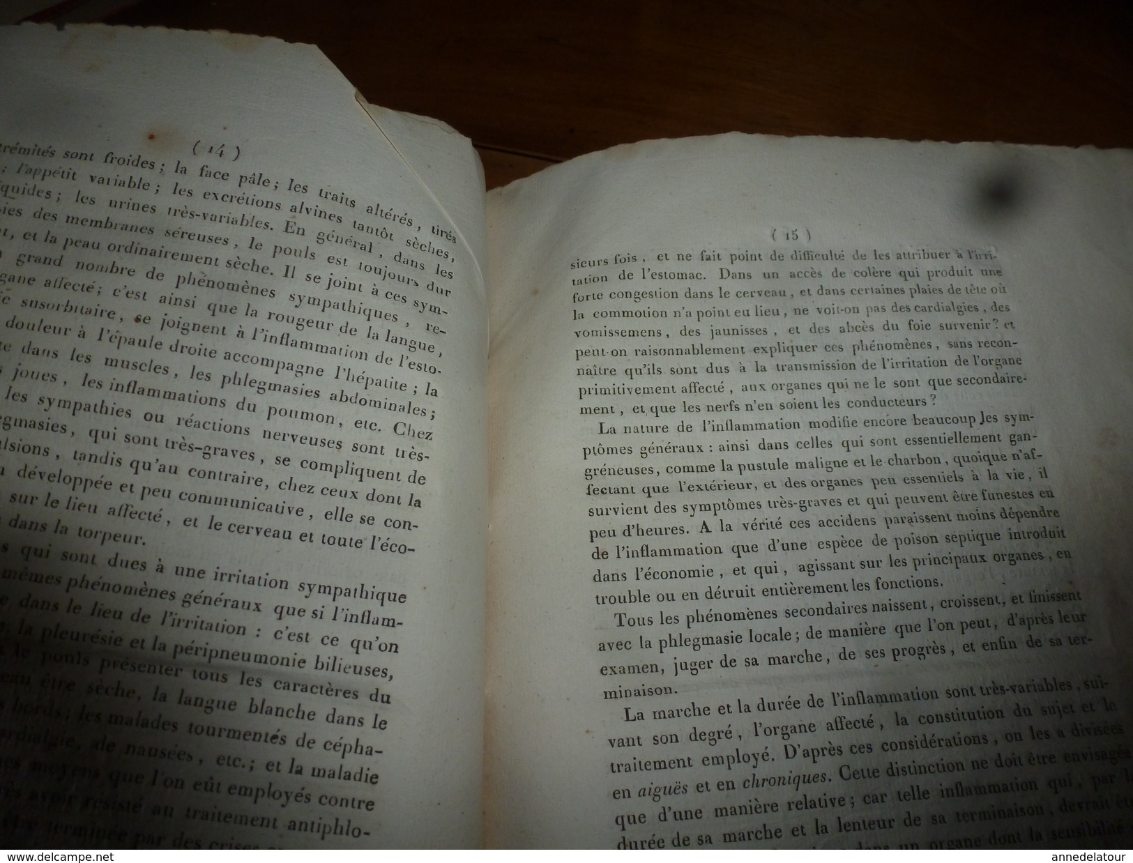 1819 (filigrane)  Rare thèse Dr J. E. Carion SUR L'INFLAMMATION EN GENERAL, présentée à Faculté de Médecine de Paris.