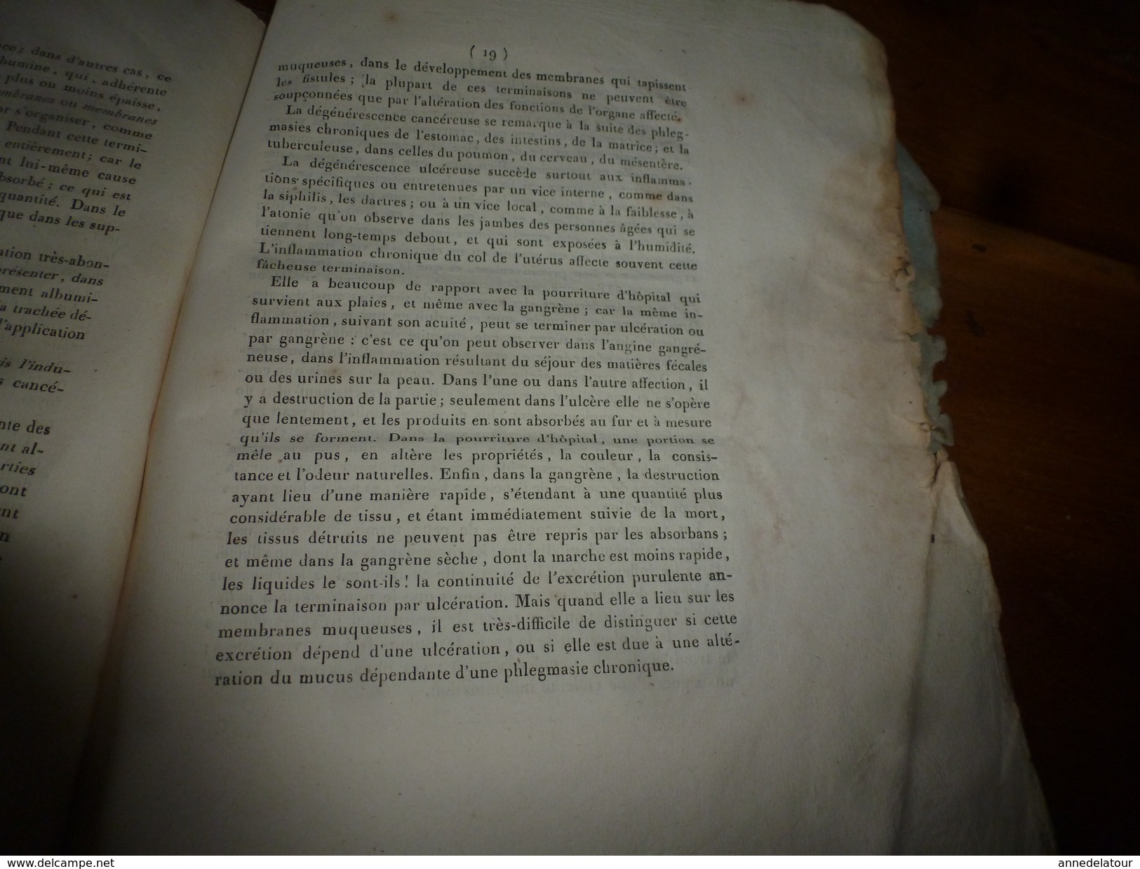 1819 (filigrane)  Rare thèse Dr J. E. Carion SUR L'INFLAMMATION EN GENERAL, présentée à Faculté de Médecine de Paris.