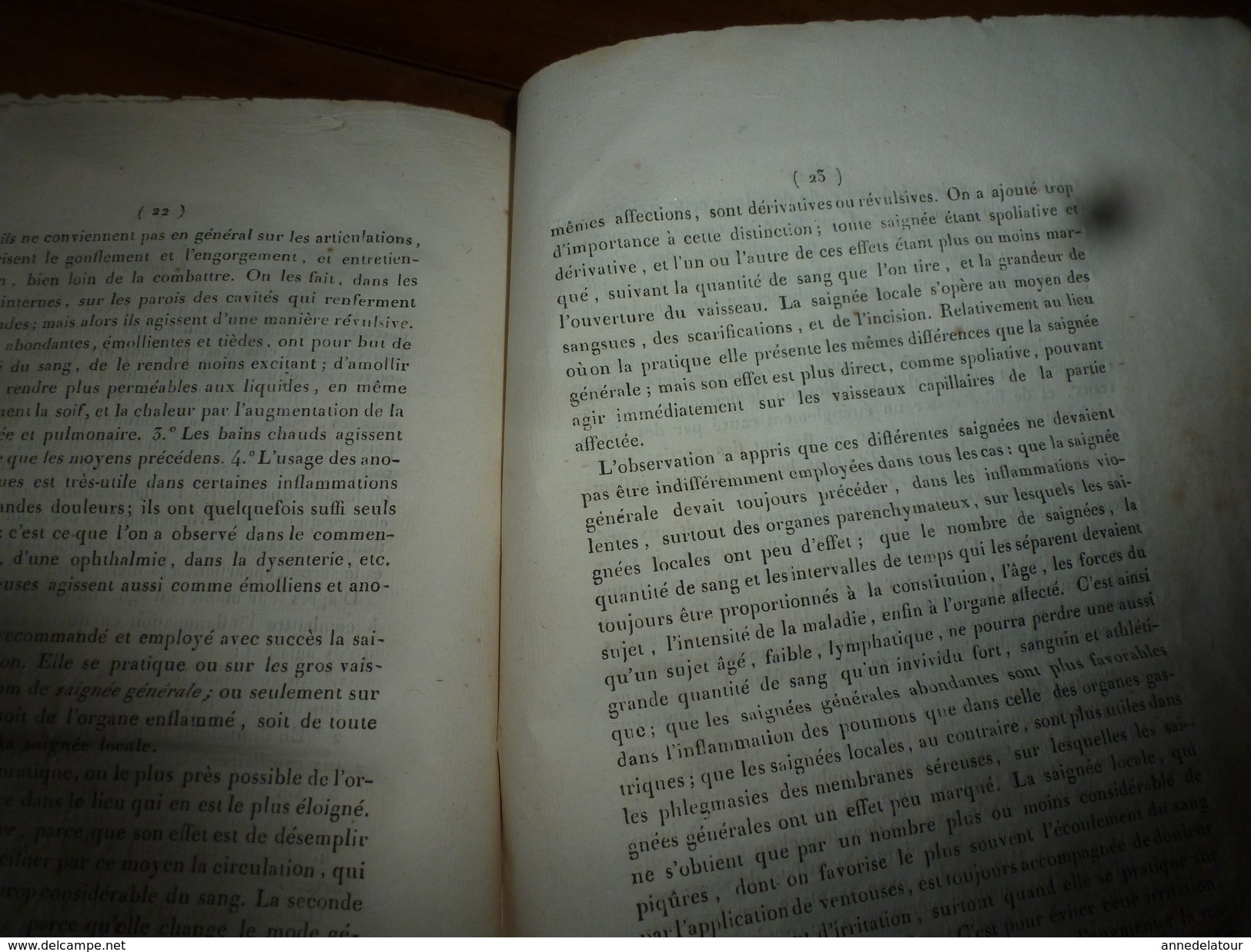 1819 (filigrane)  Rare thèse Dr J. E. Carion SUR L'INFLAMMATION EN GENERAL, présentée à Faculté de Médecine de Paris.