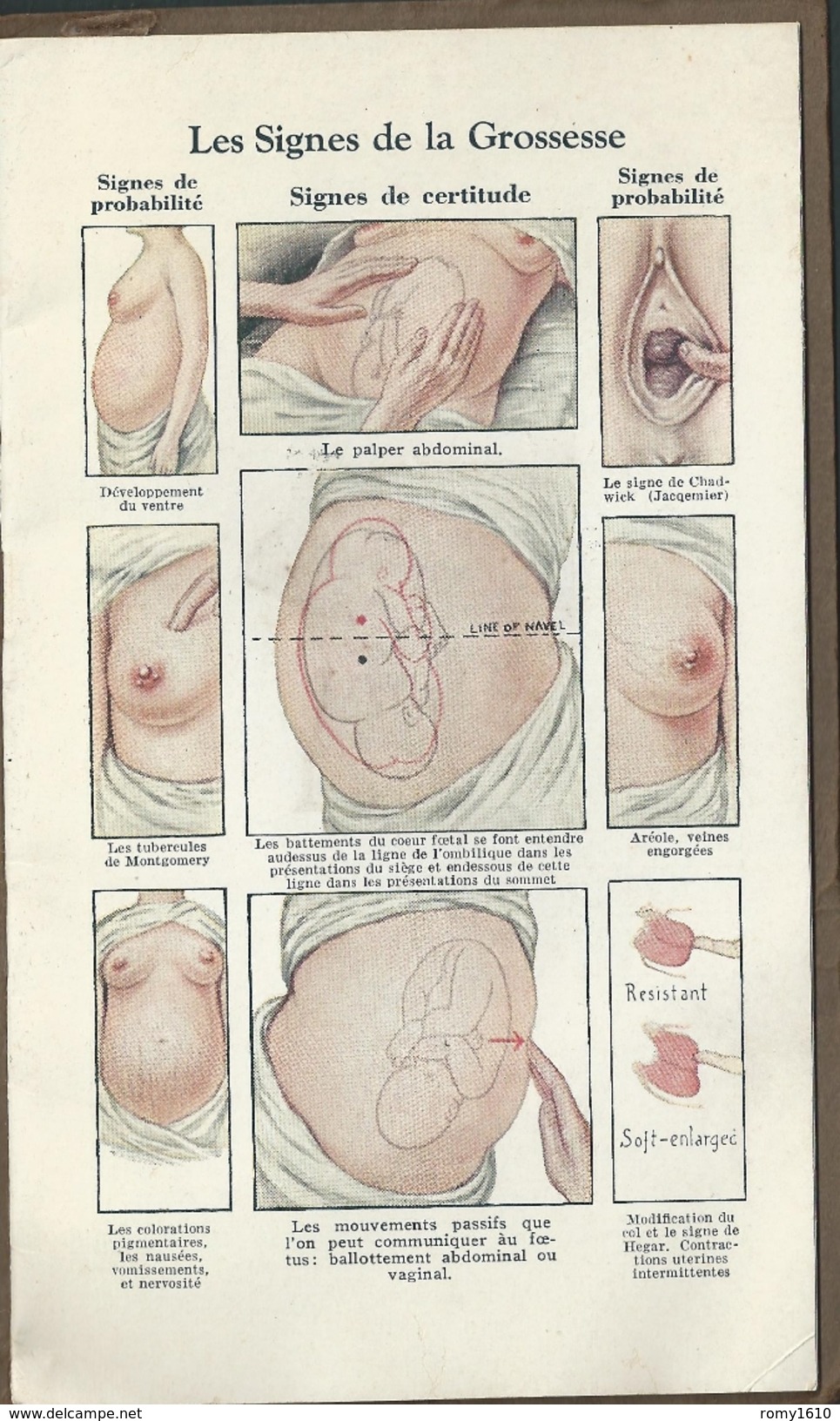 Médecine. La Grossesse. Ses Signes Et Ses Complications. Petit Livre De 16 Pages. 9 Pages Illustrées. 1930. - Santé