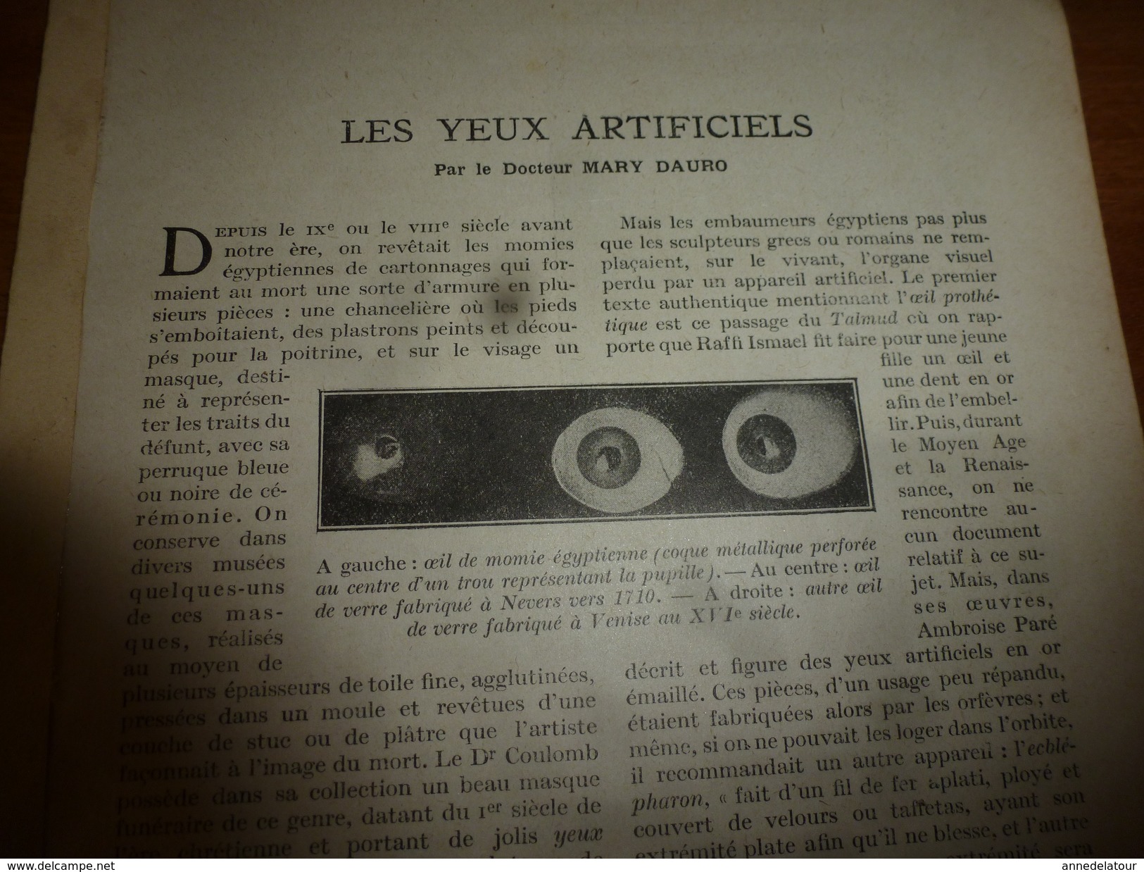 1917 LSELV :Les YEUX ARTIFICIELS  (par Le Docteur Mary Dauro) - Autres & Non Classés