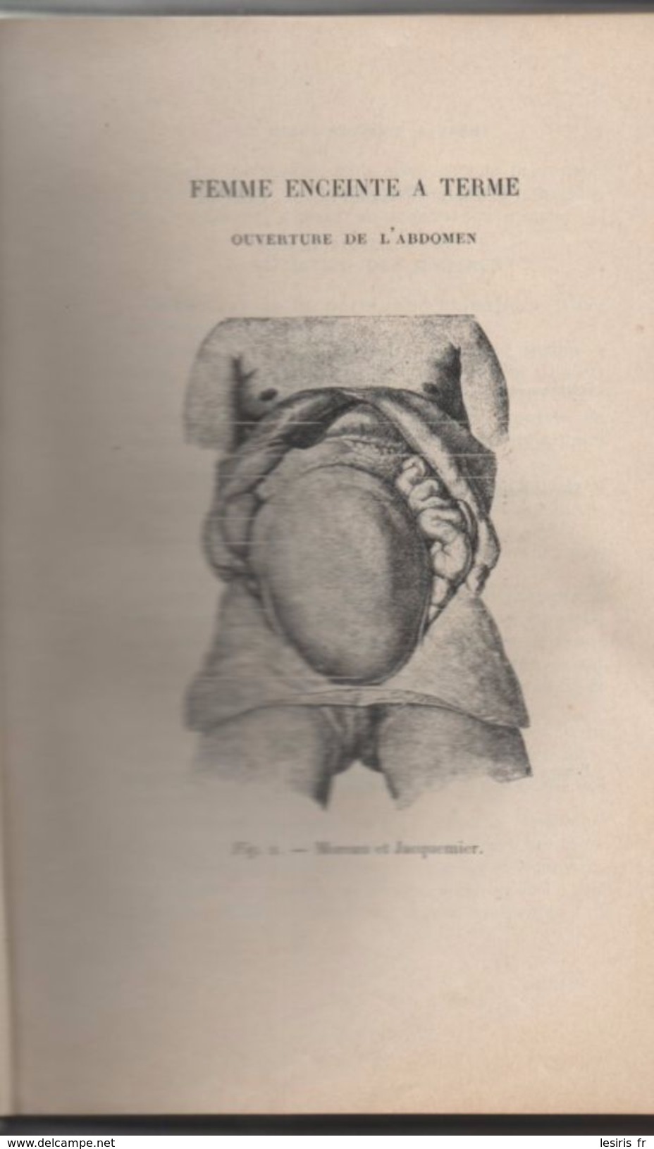 V. WALLICK - ÉLÉMENTS D'OBSTÉTRIQUE - 2° EDITION - 135 FIGURES - 1910 - G. STEINHEIL - - Salud