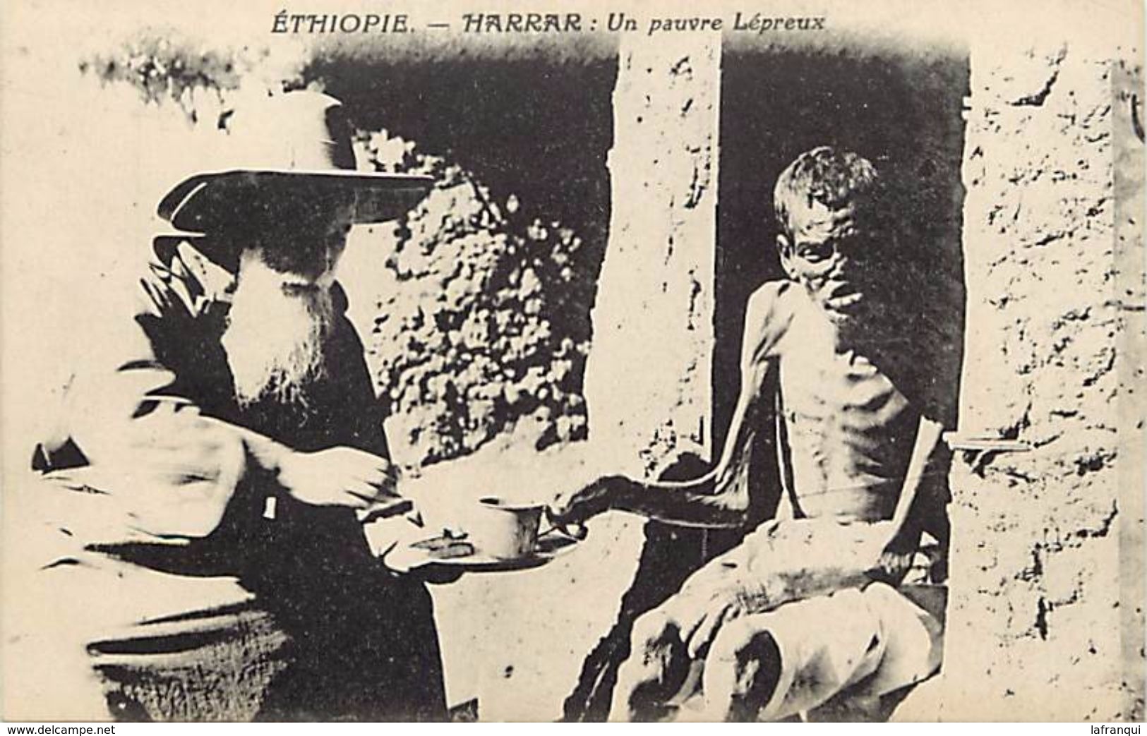 Ref V156- Ethiopie - Harrar - Santé - La Lepre - Harrar - Un Pauvre Lepreux   - Carte Bon Etat  - - Ethiopie