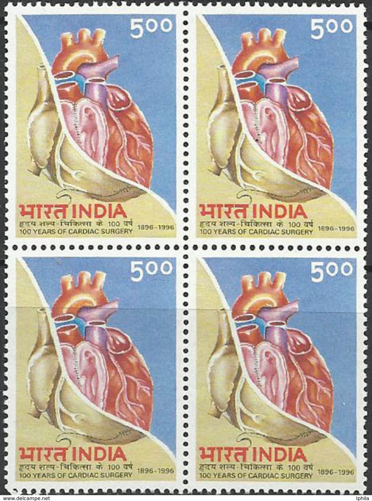 Cardiac Surgery BLOCK   Medical Health Medicine Gesundheit Médicament Santé Médical India Chirurgie Heart Disease - Medicine