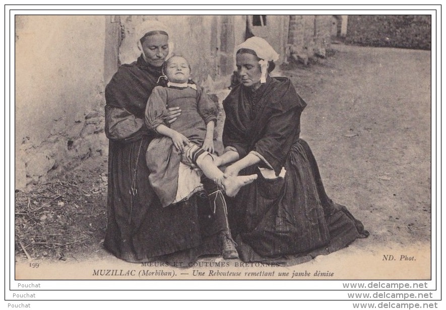 56) MOEURS ET COUTUMES BRETONNES - ENVIRONS DE MUZILLAC  (MORBIHAN) UNE REBOUTEUSE  REMETTANT UNE JAMBE DÉMISE - Autres & Non Classés