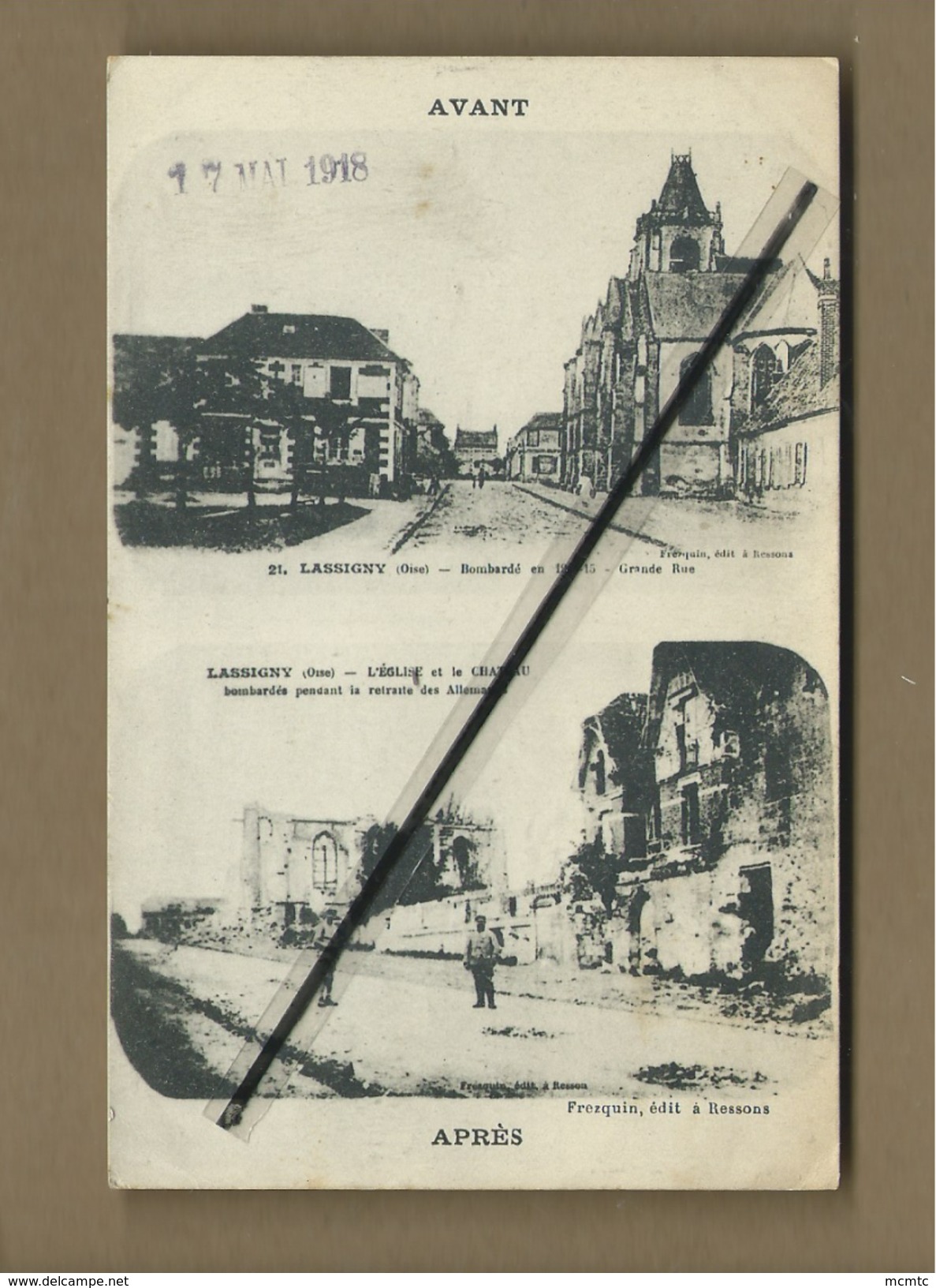 CPA  -  Avant -  Lassigny Bombardée En 1914-15 Grande Rue - Après - Lassigny - L'église Et La Château Bombardée ...etc.. - Lassigny