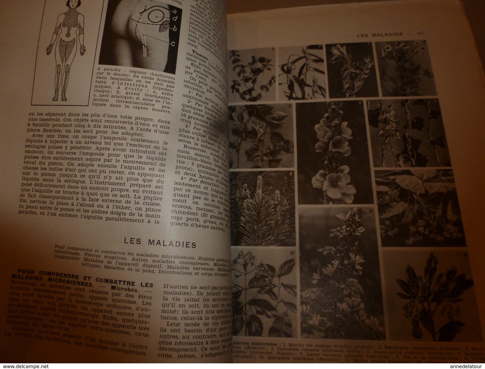 1950 ENCYCLOPEDIE FAMILIALE LAROUSSE ->Les Maladies,Salle De Séjour, Les Grands Fléaux Sociaux, Les Accidents - Encyclopaedia
