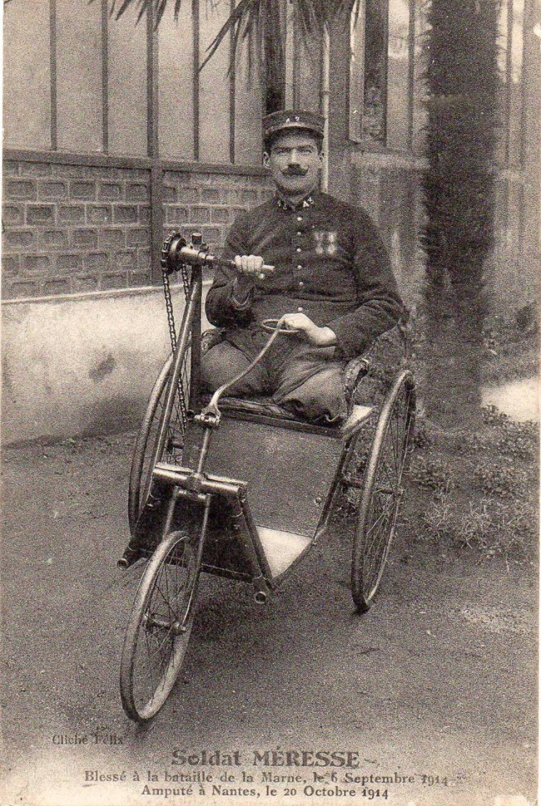 Cpa MILITARIA   SOLDAT MERESSE   Blesse A La Bataille De La Marne 1914  Ampute A Nantes - Guerre 1914-18