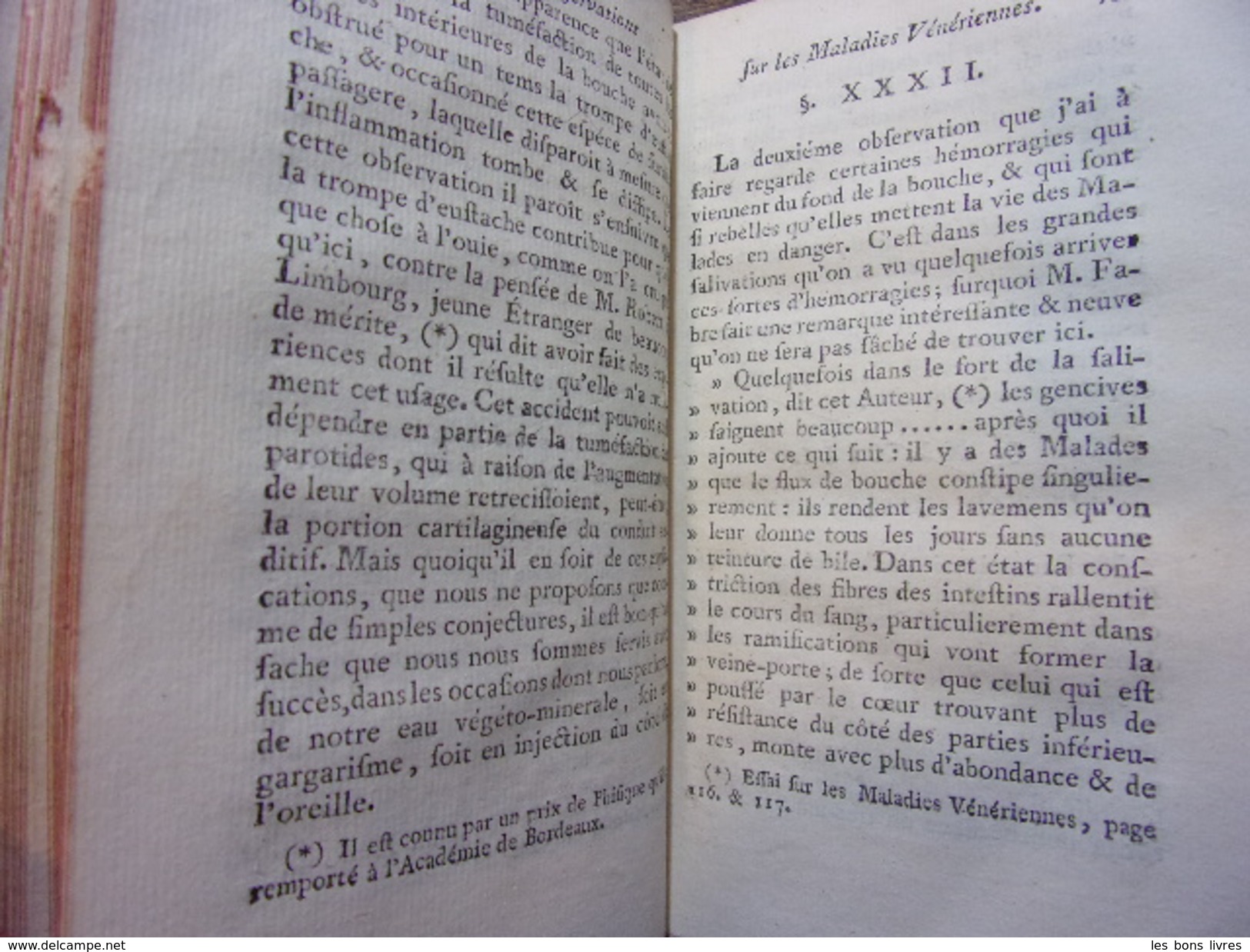 REMARQUES & OBSERVATIONS PRATIQUES SUR LES MALADIES VÉNÉRIENNES - Tot De 18de Eeuw