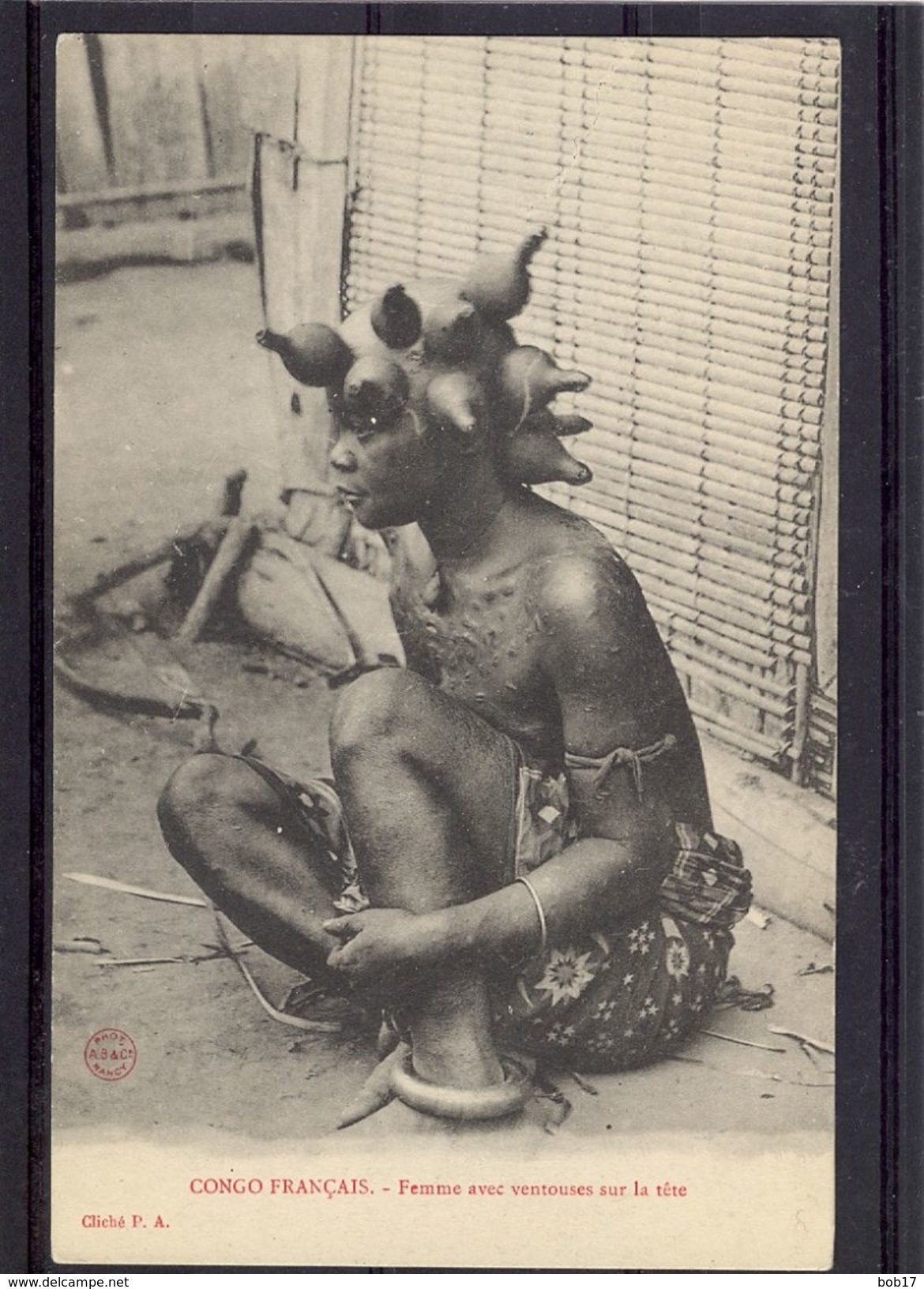 Femme Avec Ventouses Sur La Tête - TBE - French Congo