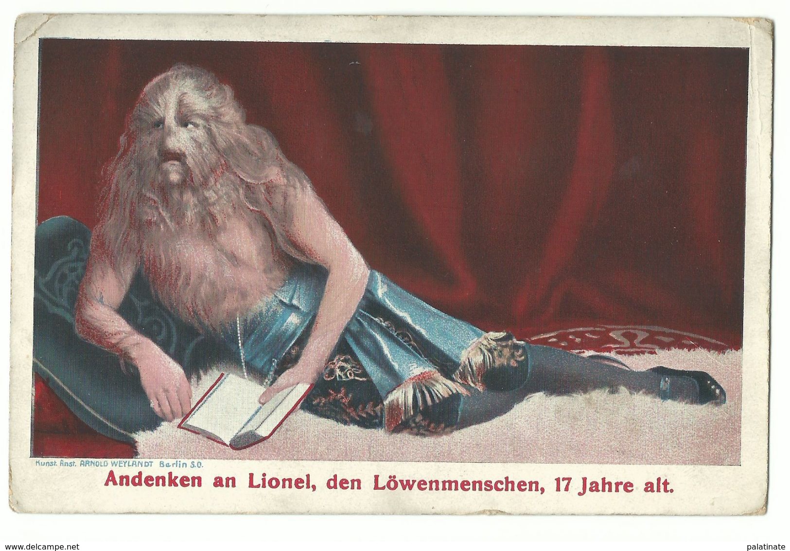 Lionel Der Löwenmensch 17 Jahre Alt Um 1910 - Künstler