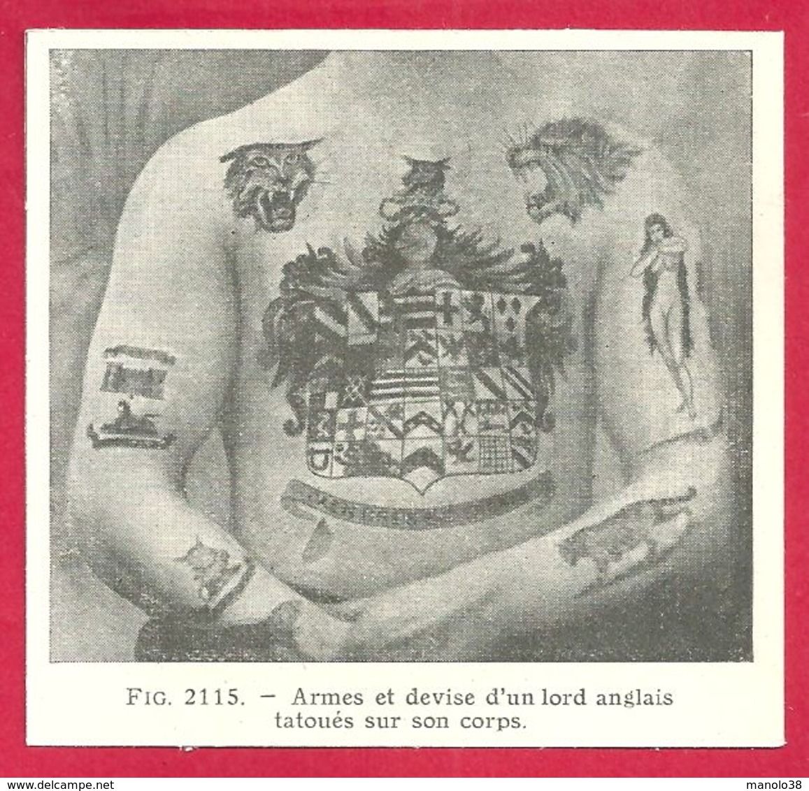 Tatouage, Armes Et Devise D'un Lord Anglais Tatoués Sur Son Corps, Larousse Médical De 1934 - Autres & Non Classés