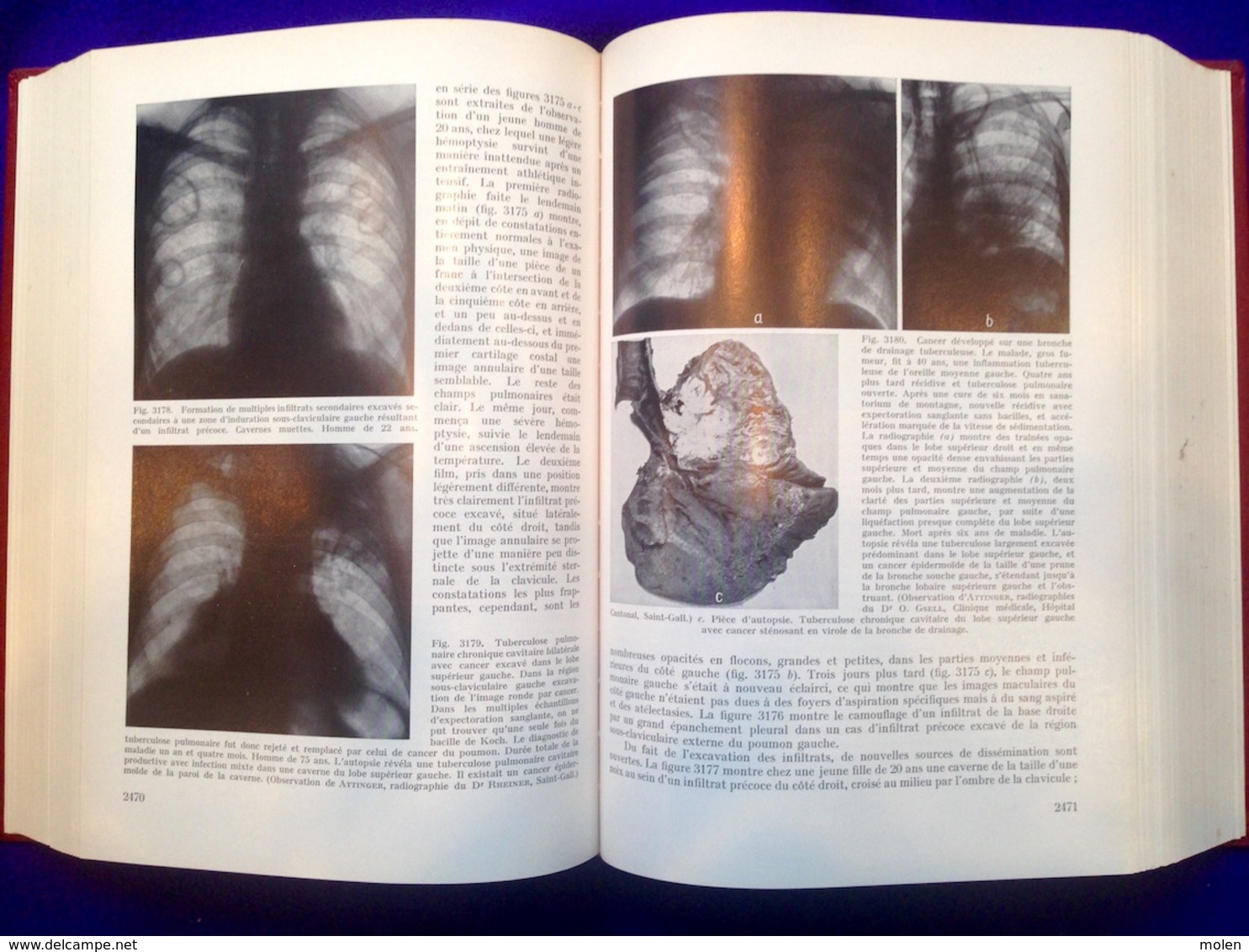 6 livres = TRAITE DE RADIODIAGNOSTIC Schinz RONTGEN RAYONS X STRALEN RAY RADIOGRAPHIE RADIOLOGIE HOPITAL CLINIQUE Z692