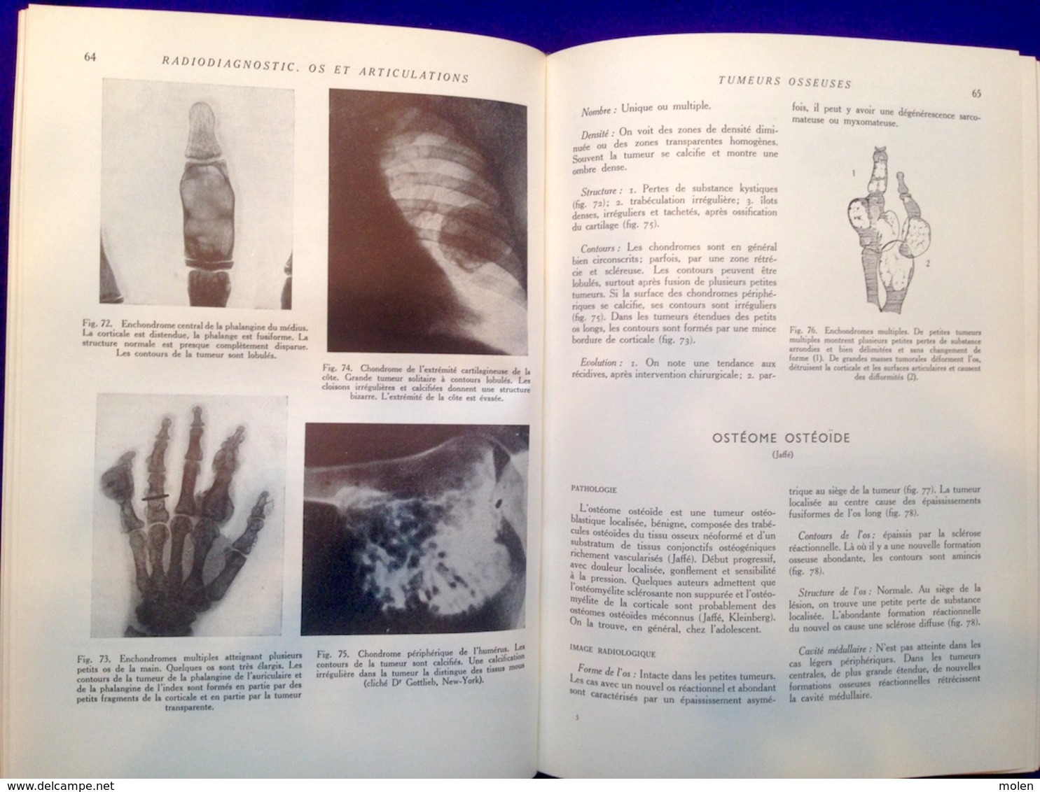 6 livres = TRAITE DE RADIODIAGNOSTIC Schinz RONTGEN RAYONS X STRALEN RAY RADIOGRAPHIE RADIOLOGIE HOPITAL CLINIQUE Z692