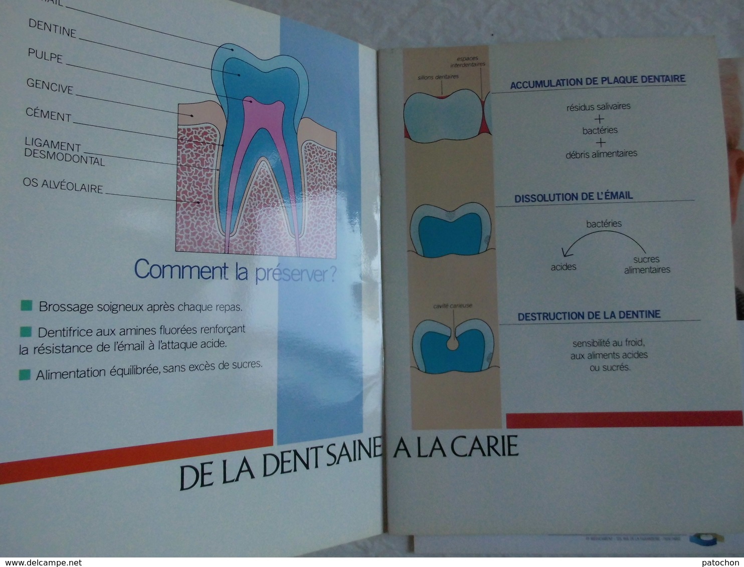 2 Plaquettes Dentiste Explicative Caries & Complications Couronnes & Bridges...! - Matériel Médical & Dentaire