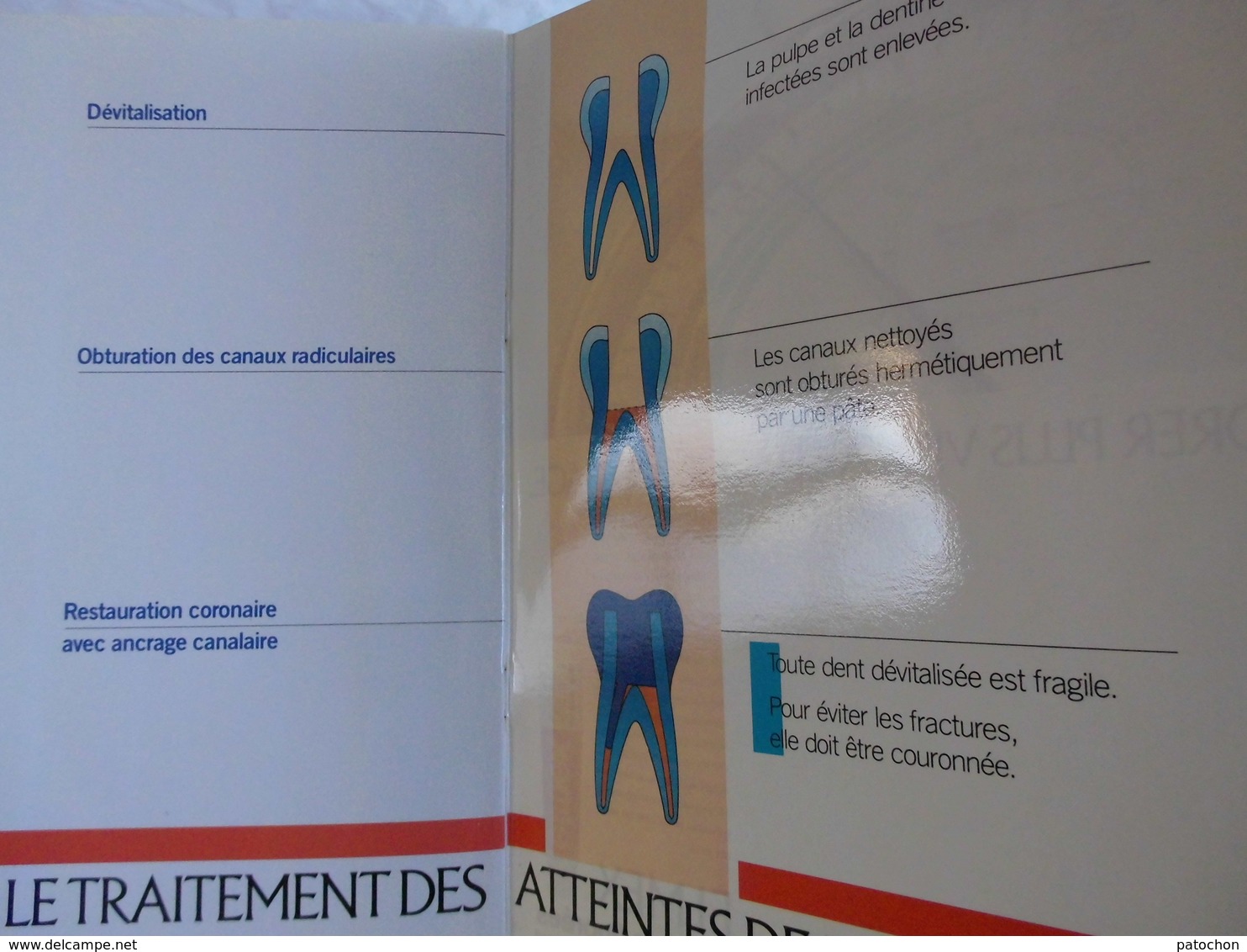 2 plaquettes Dentiste explicative Caries & Complications Couronnes & Bridges...!